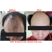 Refine Naturals™ ECZEMA